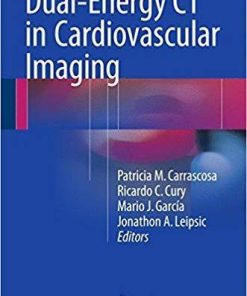 Dual-Energy CT in Cardiovascular Imaging 1st ed. 2015 Edition