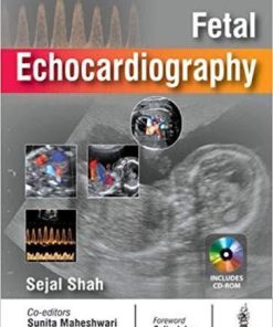 Fetal Echocardiography 1st Edition