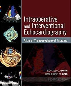 Intraoperative and Interventional Echocardiography: Atlas of Transesophageal Imaging 2nd Edition