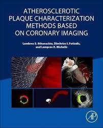 Atherosclerotic Plaque Characterization Methods Based on Coronary Imaging 1st Edition