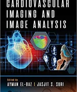 Cardiovascular Imaging and Image Analysis (3d Photorealistic Rendering) 1st Edition