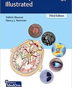 Neuro-Ophthalmology Illustrated (Inglés) 3rd Edición