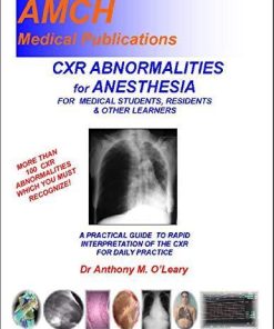 CHEST X RAY ABNORMALITIES FOR ANESTHESIA: A practical guide to rapid interpretation of the Chest X Ray for safe daily practice of anesthesia