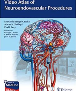 Video Atlas of Neuroendovascular Procedures (Inglés) 1st Edición (VIDEO + PDF)