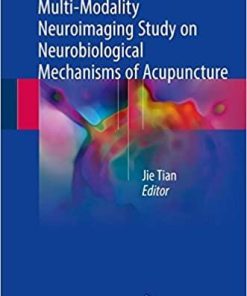 Multi-Modality Neuroimaging Study on Neurobiological Mechanisms of Acupuncture 1st ed. 2018 Edition