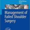 Management of Failed Shoulder Surgery 1st ed. 2018 Edition