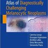 Atlas of Diagnostically Challenging Melanocytic Neoplasms 1st ed. 2018 Edition