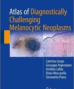 Atlas of Diagnostically Challenging Melanocytic Neoplasms 1st ed. 2018 Edition