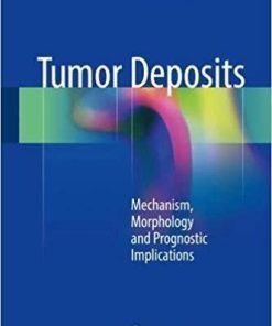 Tumor Deposits: Mechanism, Morphology and Prognostic Implications 1st ed. 2018 Edition