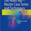 The Adult Hip – Master Case Series and Techniques 1st ed. 2018 Edition