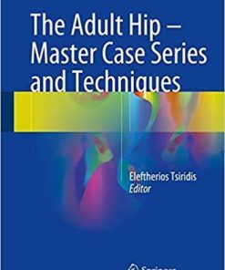 The Adult Hip – Master Case Series and Techniques 1st ed. 2018 Edition