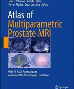 Atlas of Multiparametric Prostate MRI: With PI-RADS Approach and Anatomic-MRI-Pathological Correlation 1st ed. 2018 Edition