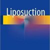 Liposuction 1st ed. 2018 Edition