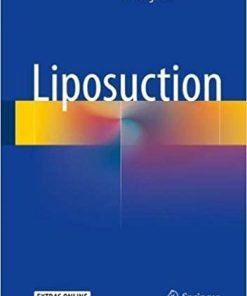 Liposuction 1st ed. 2018 Edition