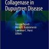 Collagenase in Dupuytren Disease 1st ed. 2018 Edition