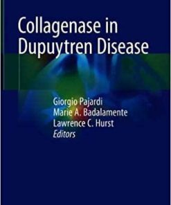 Collagenase in Dupuytren Disease 1st ed. 2018 Edition