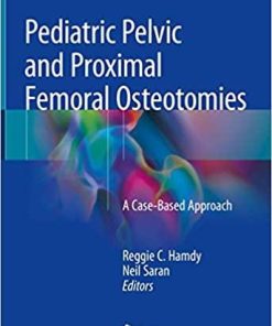 Pediatric Pelvic and Proximal Femoral Osteotomies: A Case-Based Approach 1st ed. 2018 Edition