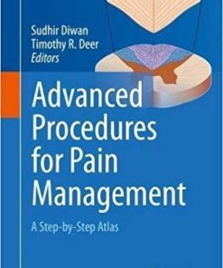 Advanced Procedures for Pain Management: A Step-by-Step Atlas 1st ed. 2018 Edition