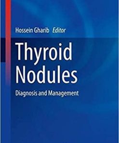 Thyroid Nodules: Diagnosis and Management (Contemporary Endocrinology) 1st ed. 2018 Edition