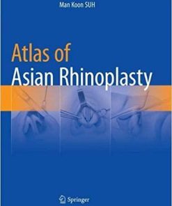 Atlas of Asian Rhinoplasty Softcover reprint of the original 1st ed. 2018 Edition