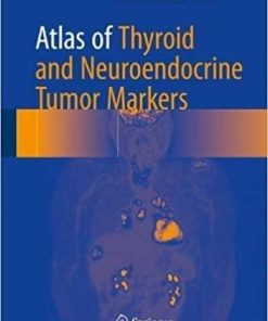 Atlas of Thyroid and Neuroendocrine Tumor Markers 1st ed. 2018 Edition