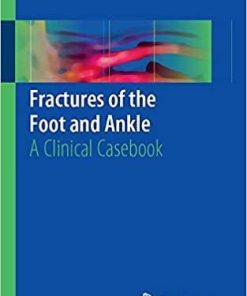 Fractures of the Foot and Ankle: A Clinical Casebook 1st ed. 2018 Edition