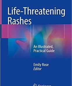 Life-Threatening Rashes: An Illustrated, Practical Guide 1st ed. 2018 Edition