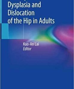 Developmental Dysplasia and Dislocation of the Hip in Adults 1st ed. 2018 Edition