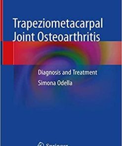 Trapeziometacarpal Joint Osteoarthritis: Diagnosis and Treatment 1st ed. 2018 Edition