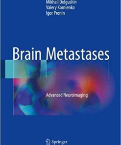 Brain Metastases: Advanced Neuroimaging 1st ed. 2018 Edition