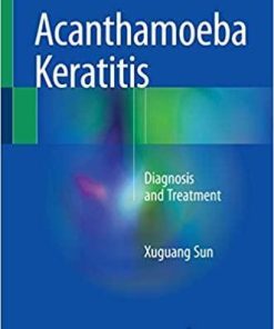 Acanthamoeba Keratitis: Diagnosis and Treatment 1st ed. 2018 Edition