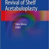 Revival of Shelf Acetabuloplasty 1st ed. 2018 Edition