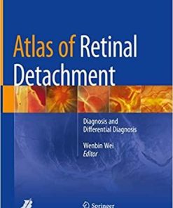 Atlas of Retinal Detachment: Diagnosis and Differential Diagnosis 1st ed. 2018 Edition