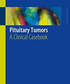 Pituitary Tumors: A Clinical Casebook