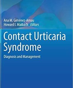 Contact Urticaria Syndrome: Diagnosis and Management (Updates in Clinical Dermatology) 1st ed. 2018 Edition