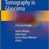 Optical Coherence Tomography in Glaucoma: A Practical Guide 1st ed. 2018 Edition