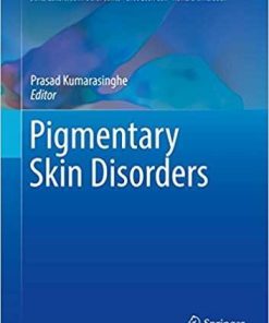 Pigmentary Skin Disorders (Updates in Clinical Dermatology) 1st ed. 2018 Edition