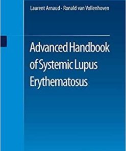 Advanced Handbook of Systemic Lupus Erythematosus 1st ed. 2018 Edition