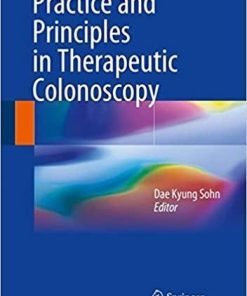 Practice and Principles in Therapeutic Colonoscopy 1st ed. 2018 Edition