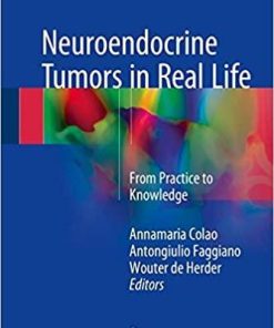 Neuroendocrine Tumors in Real Life: From Practice to Knowledge 1st ed. 2018 Edition