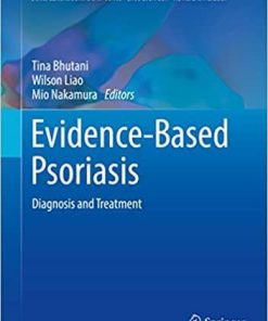 Evidence-Based Psoriasis: Diagnosis and Treatment (Updates in Clinical Dermatology) 1st ed. 2018 Edition