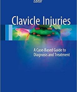 Clavicle Injuries: A Case-Based Guide to Diagnosis and Treatment 1st ed. 2018 Edition