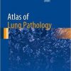 Atlas of Lung Pathology (Atlas of Anatomic Pathology) 1st ed. 2018 Edition