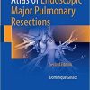 Atlas of Endoscopic Major Pulmonary Resections 2nd ed. 2018 Edition