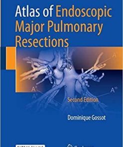 Atlas of Endoscopic Major Pulmonary Resections 2nd ed. 2018 Edition