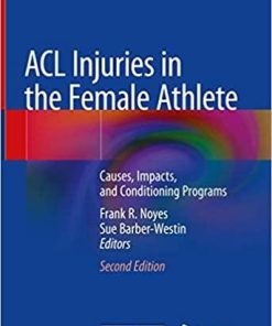 ACL Injuries in the Female Athlete: Causes, Impacts, and Conditioning Programs 2nd ed. 2018 Edition