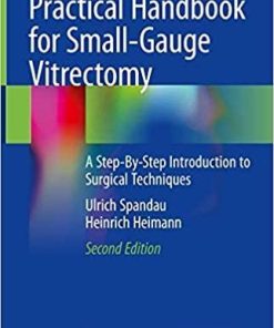 Practical Handbook for Small-Gauge Vitrectomy: A Step-By-Step Introduction to Surgical Techniques 2nd ed. 2018 Edition