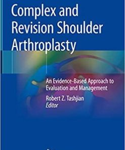 Complex and Revision Shoulder Arthroplasty: An Evidence-Based Approach to Evaluation and Management 1st ed. 2019 Edition