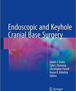 Endoscopic and Keyhole Cranial Base Surgery 1st ed. 2019 Edition