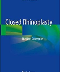 Closed Rhinoplasty: The Next Generation 1st ed. 2019 Edition